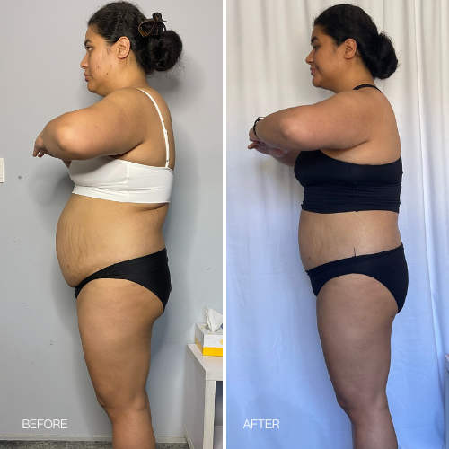 Before & After results 14 day Detox Tea