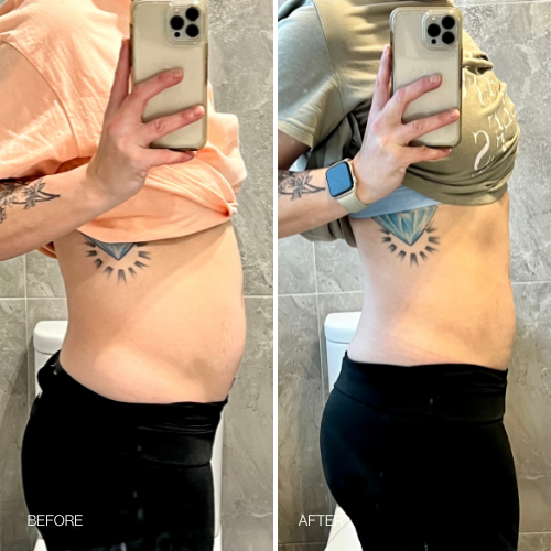 Before & After results 14 day Detox Tea