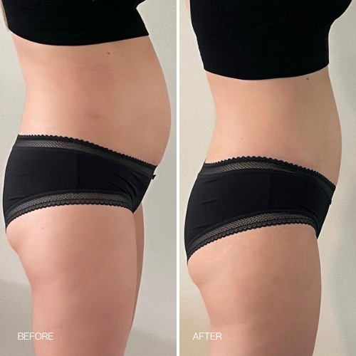 Before & After results 14 day Detox Tea