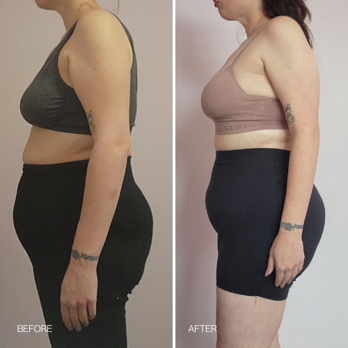 Before & After results 14 day Detox Tea