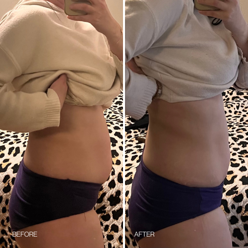 Before & After results 14 day Detox Tea