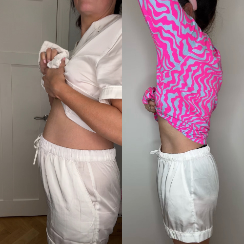 Before & After results 14 day Detox Tea