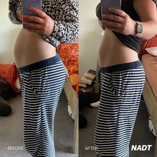 Before & After results 14 day Detox Tea